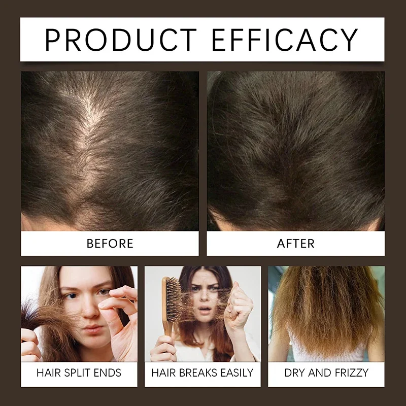 Biotin Hair Growth Spray - Image 3