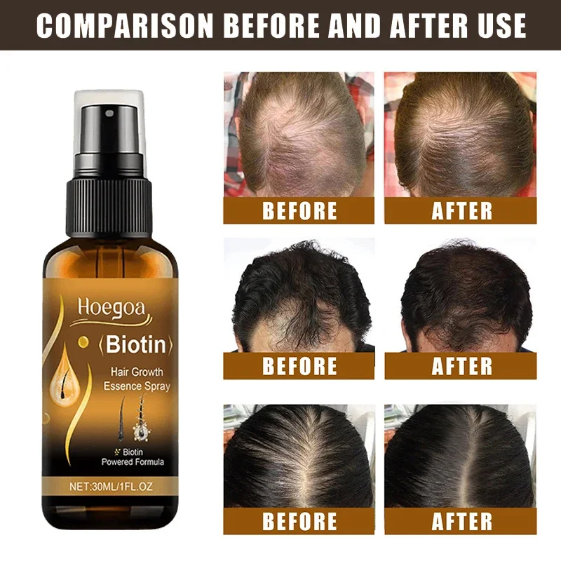 Biotin Hair Growth Spray - Image 4