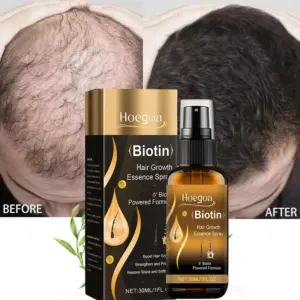 Biotin Hair Growth Spray
